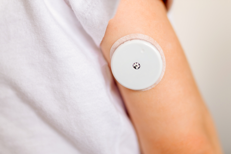 Smart Patches and Wearables: Monitoring Health 24/7