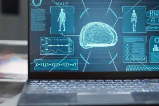 AI in Diagnostics: Faster, Smarter, More Accurate
