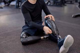 Enhancing Rehabilitation with AI-Powered Prosthetics