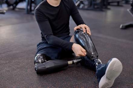 Enhancing Rehabilitation with AI-Powered Prosthetics