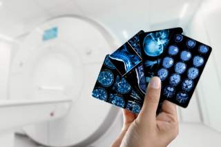 How AI is Revolutionizing MRI and CT Scans